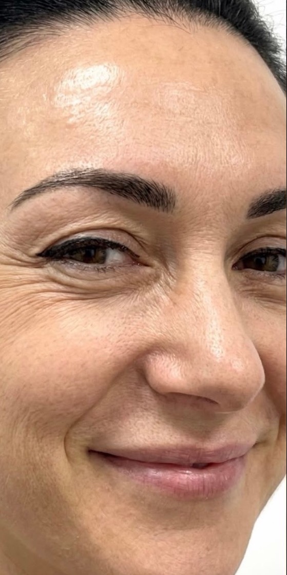 Vorher-Ansicht: Gesicht vor der Beauty-Behandlung
